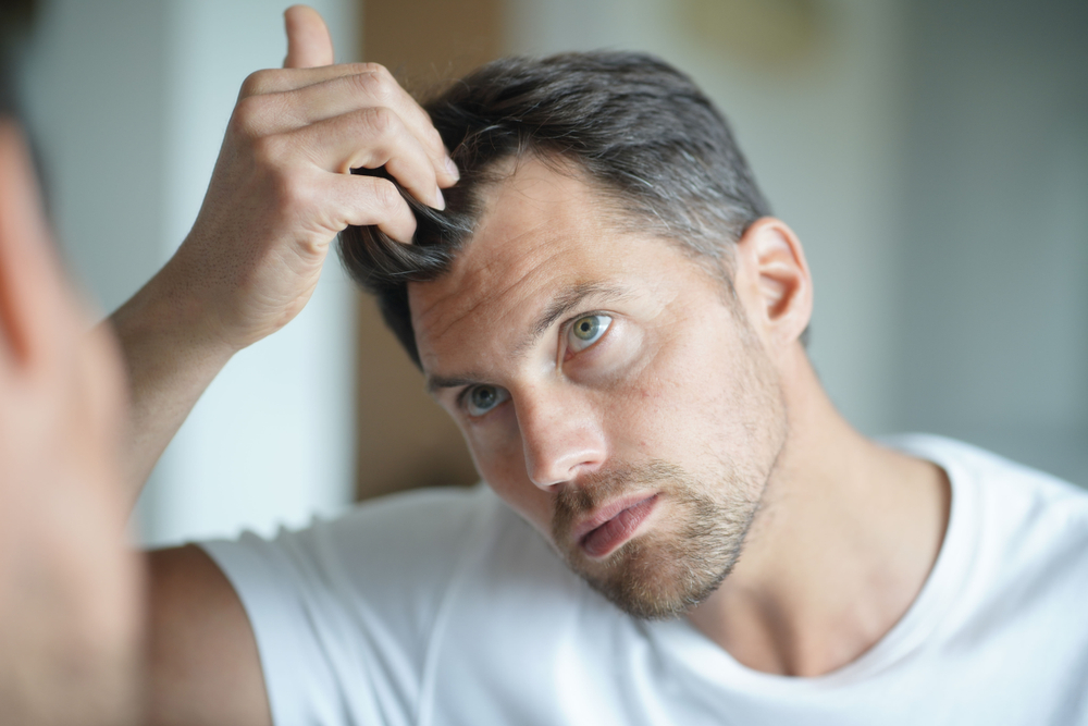 Causes of hair loss in men